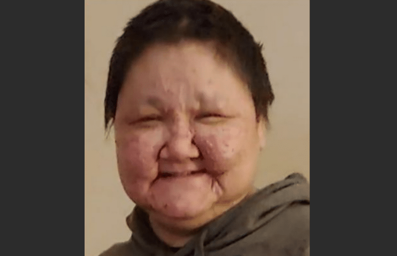 Missing Woman's Body Found Mummified on Couch