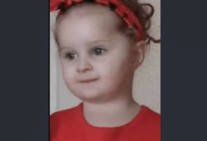 3-Year-Old Girl Dies After Lice Infestation