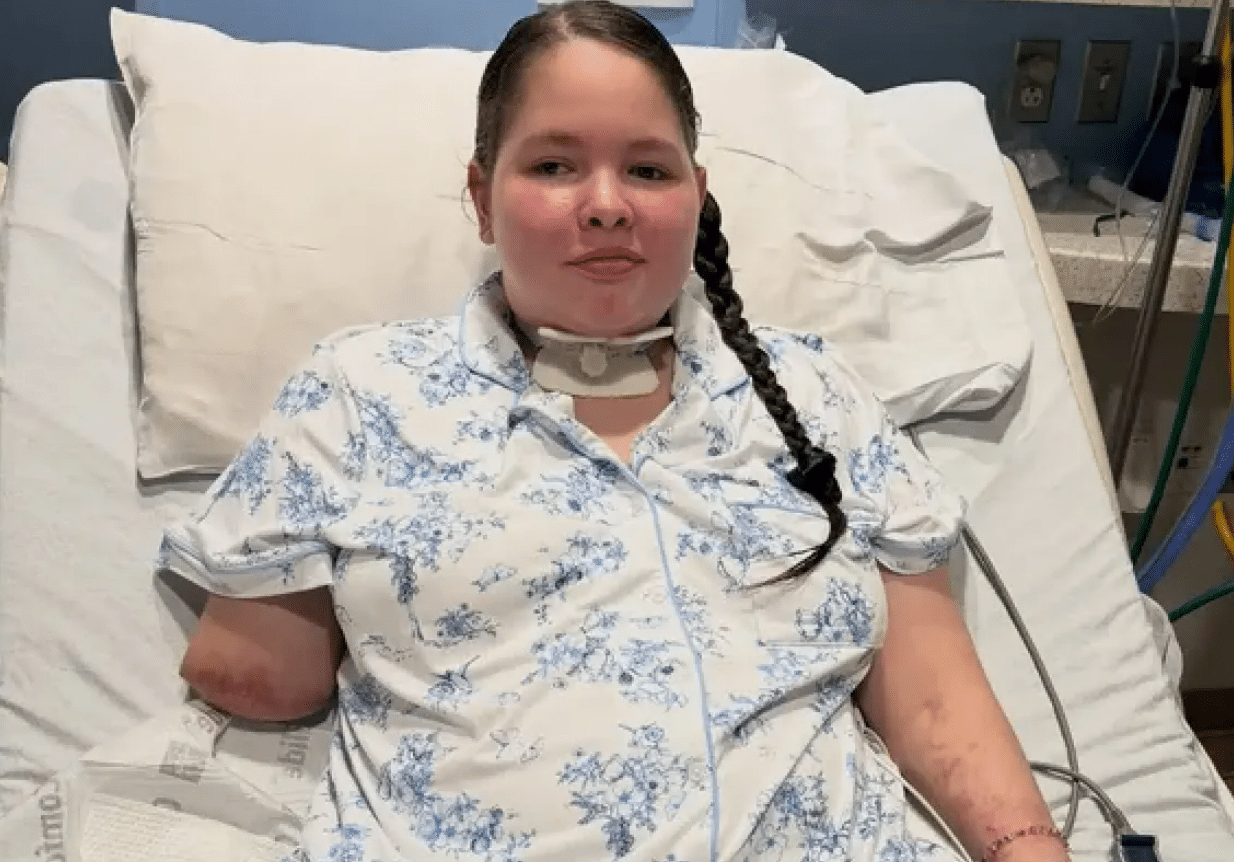 Teen Girl Loses Three Limbs After Common Illness