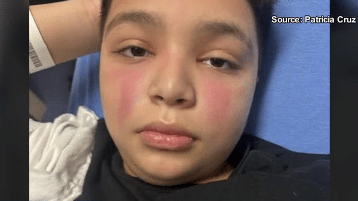 11-Year-Old Diagnosed With Rare Disease